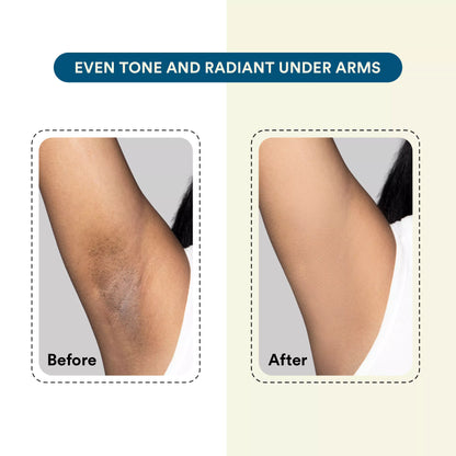 Radiate | Brightening Underarm Roll-on